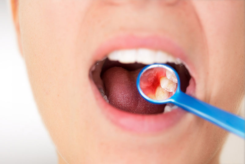dental-patient-in-need-of-periodontal-treatment-1
