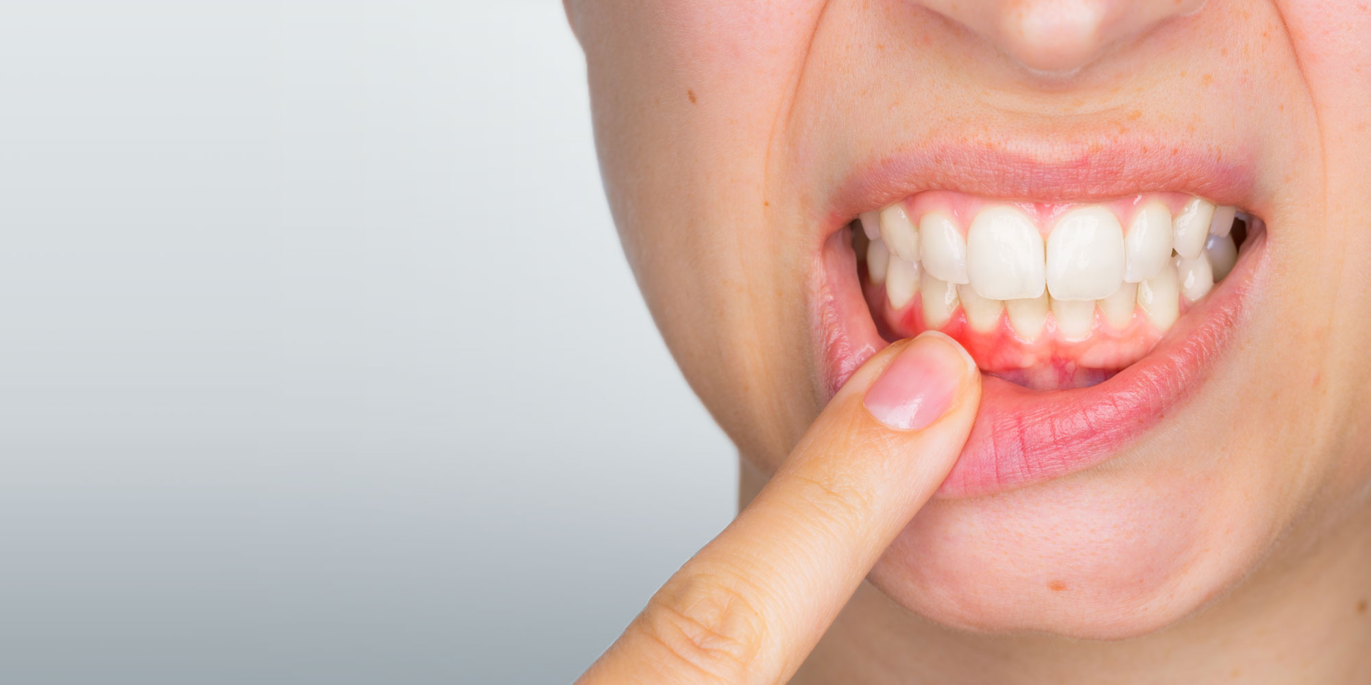 dental-patient-in-need-of-periodotnal-treatment