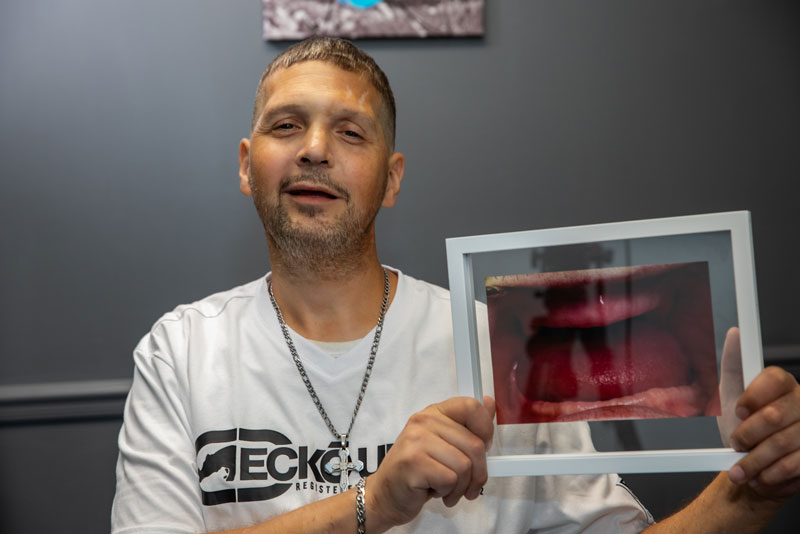 matt dental implants patient