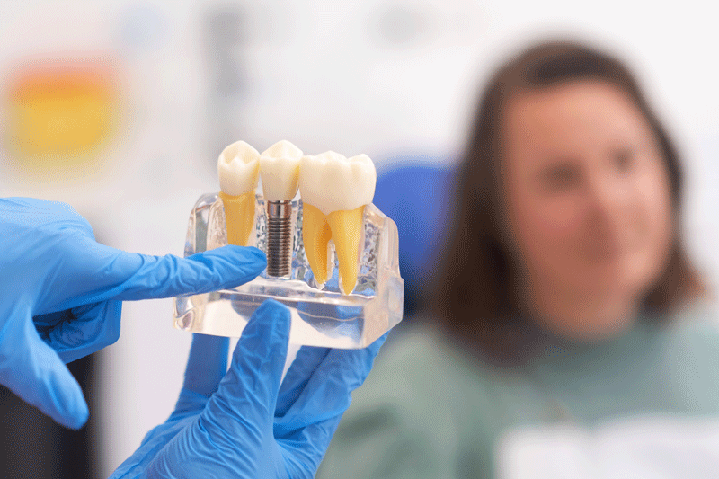 Woman holding tooth model during consultation on dental implant.